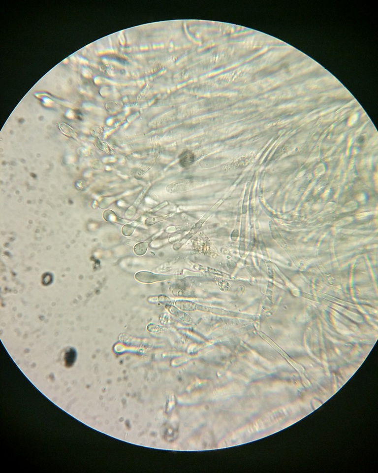Vibrissea filisporia image