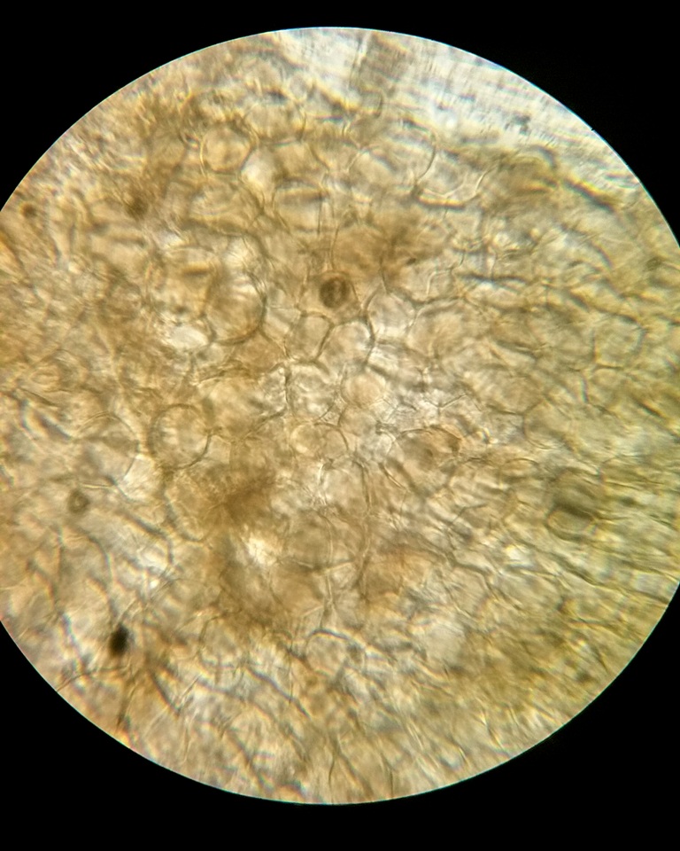 Vibrissea filisporia image