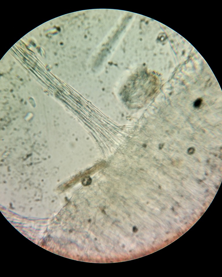Pezoloma marchantiae image