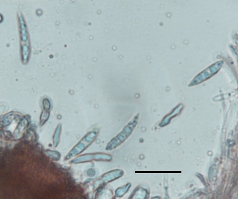 Hymenoscyphus calyculus image