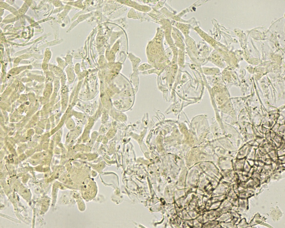 Pseudombrophila cervaria image