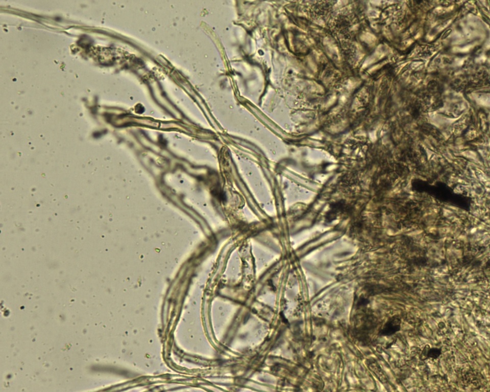 Ascorhizoctonia image