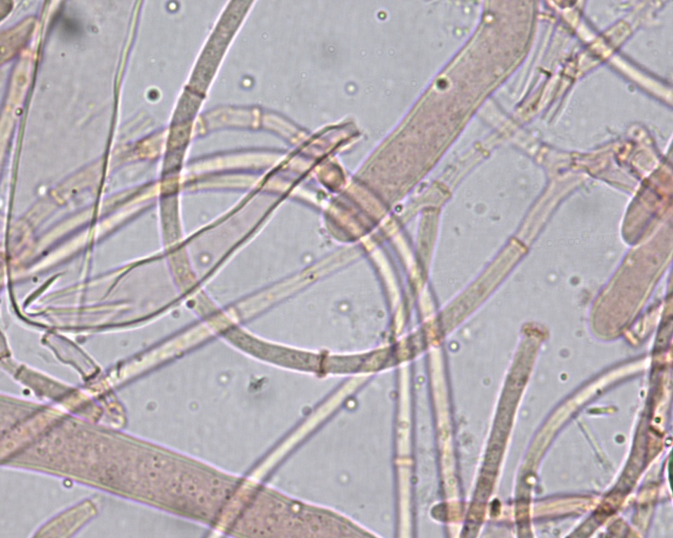 Peziza ripensis image
