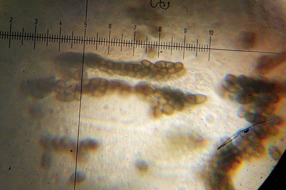 Muellerella erratica image