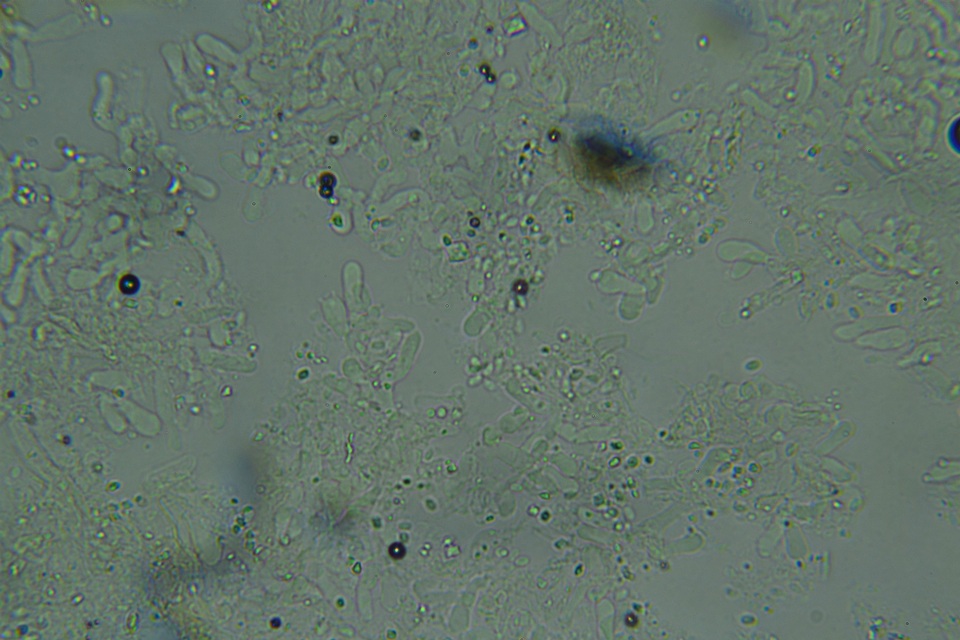 Odonticium laxum image