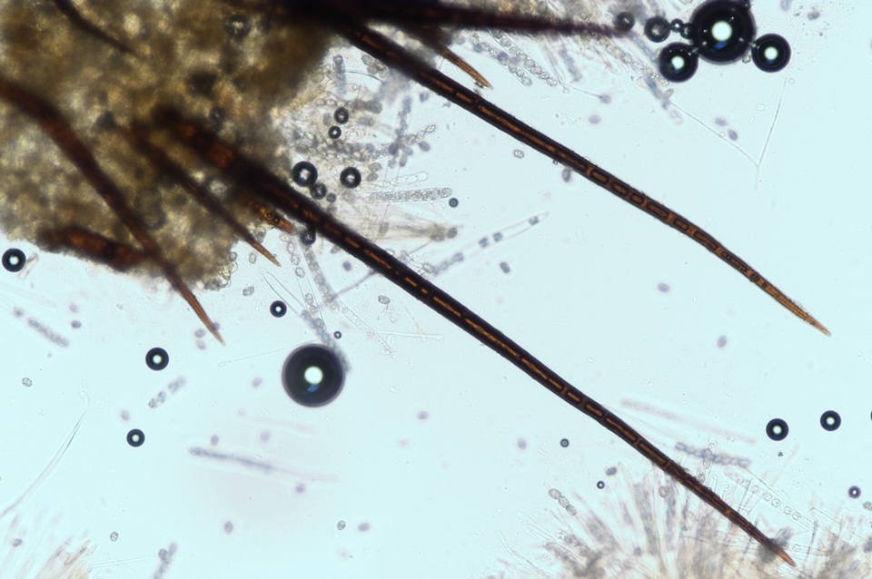 Scutellinia pennsylvanica image