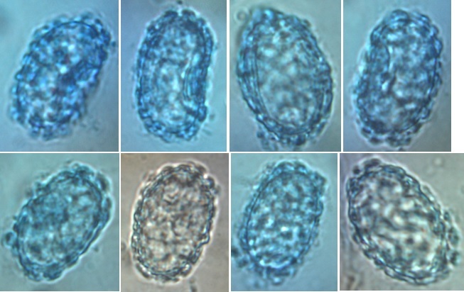 Scutellinia pennsylvanica image