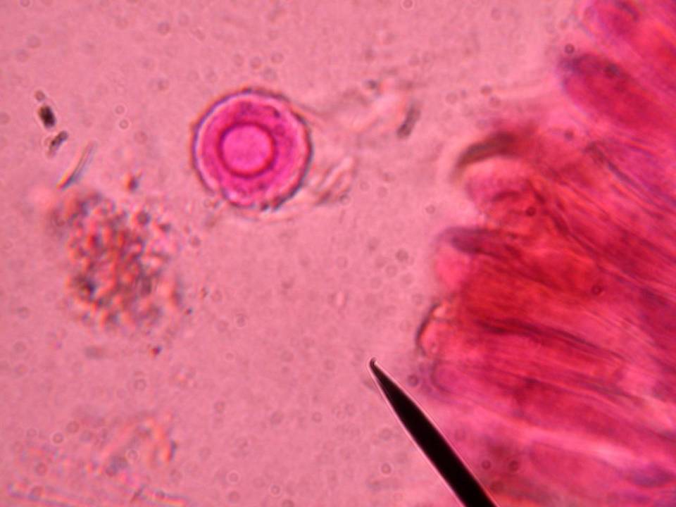 Lamprospora polytrichi image