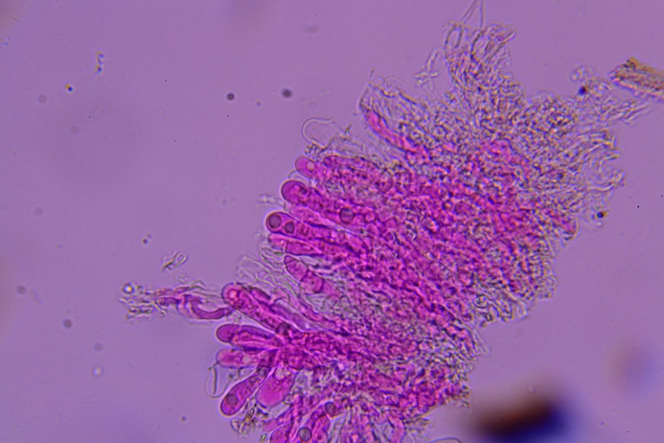 Radulomyces confluens image