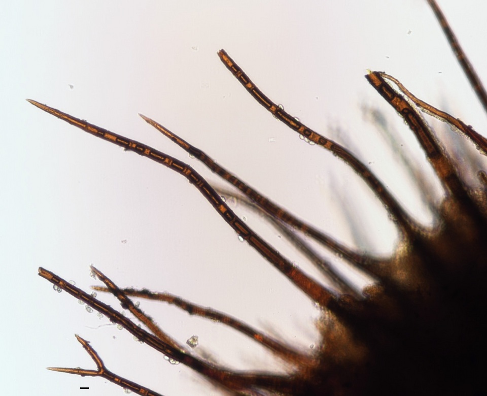 Scutellinia erinaceus image