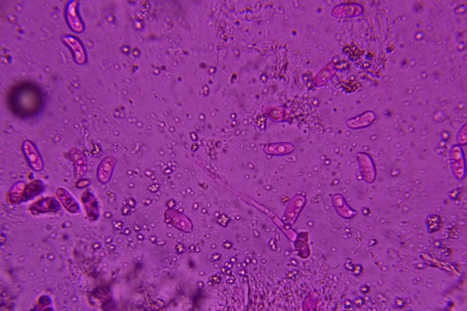 Eichleriella macrospora image