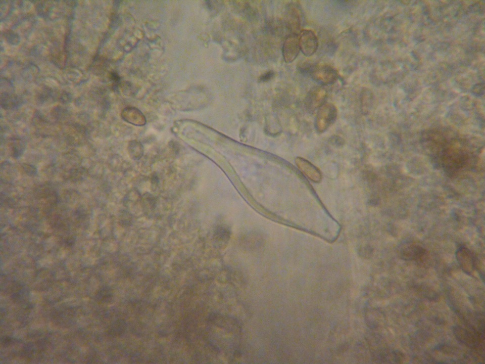 Inocybe leiocephala image