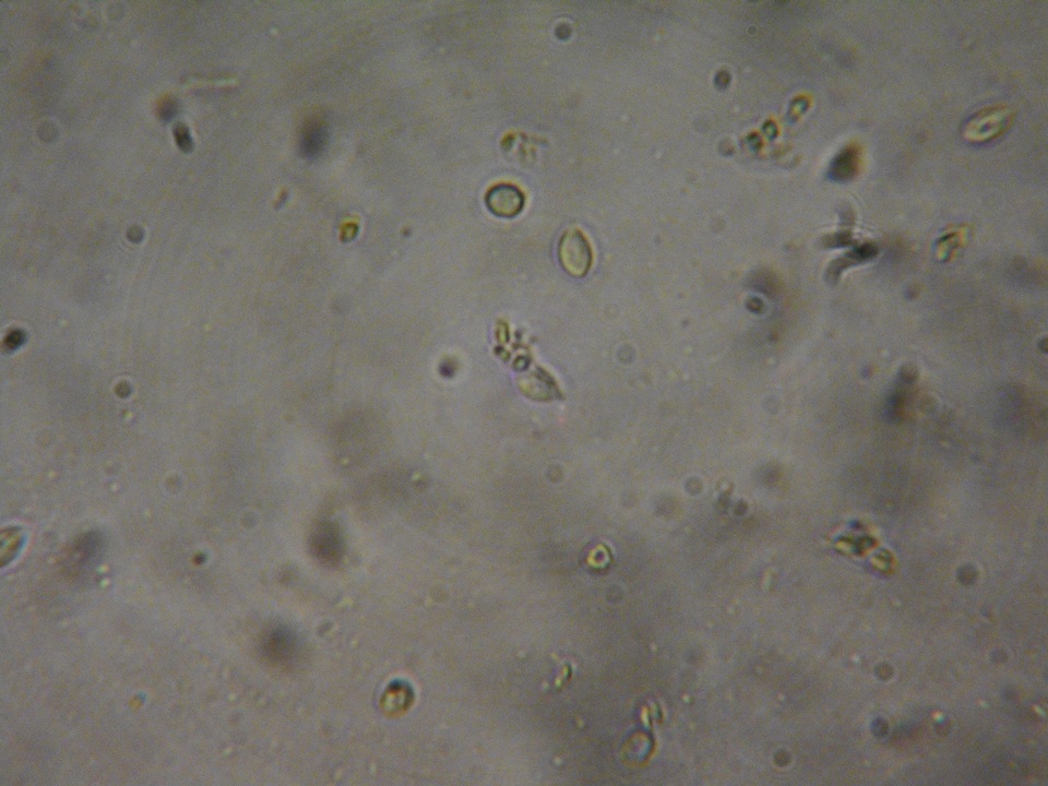 Rhodocybe aureicystidiata image
