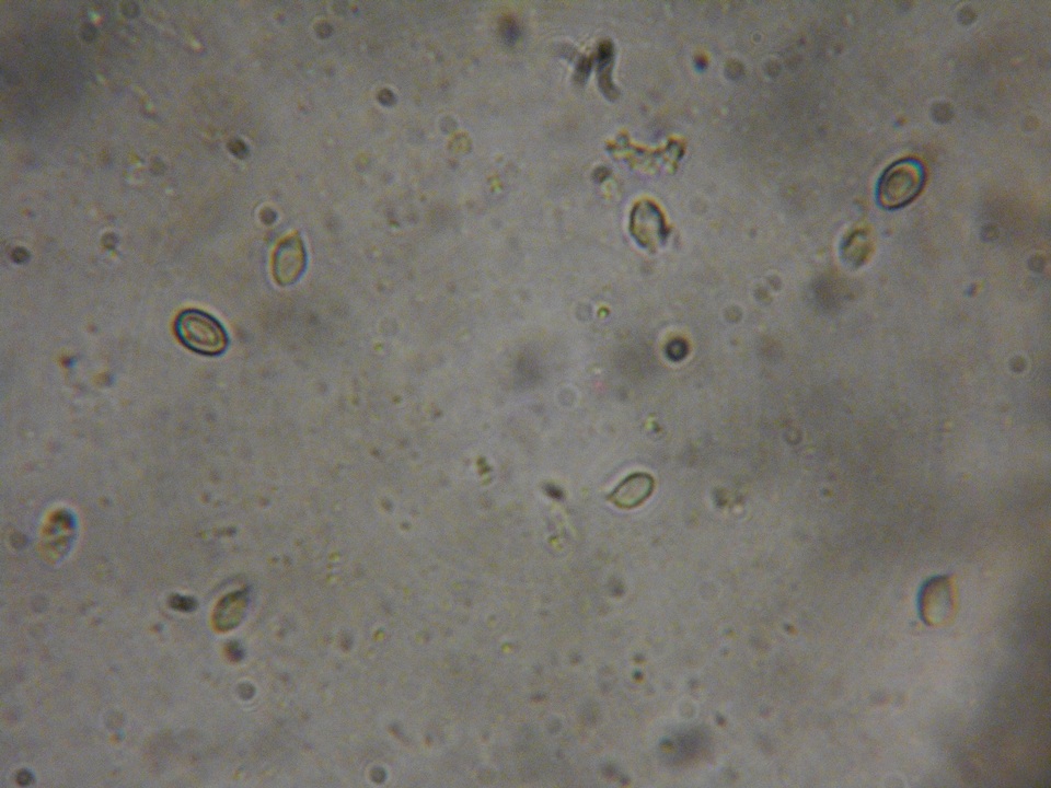 Rhodocybe aureicystidiata image