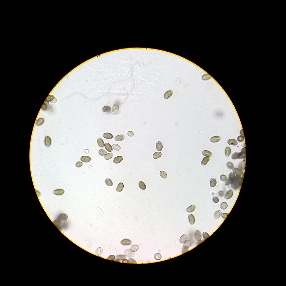 Coprinopsis canoceps image