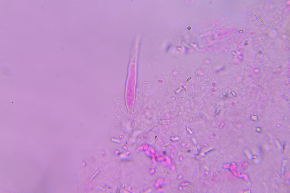 Hyphoderma probatum image