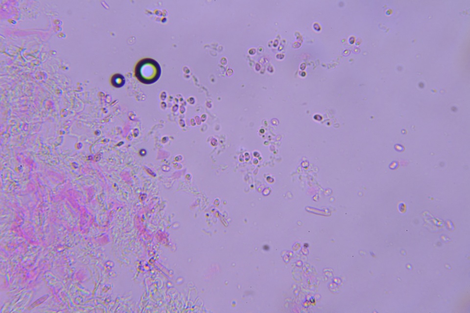 Hyphoderma probatum image