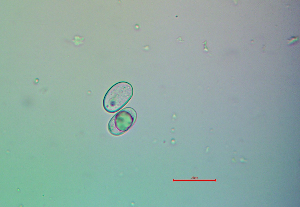 Aspicilia glaucopsina image