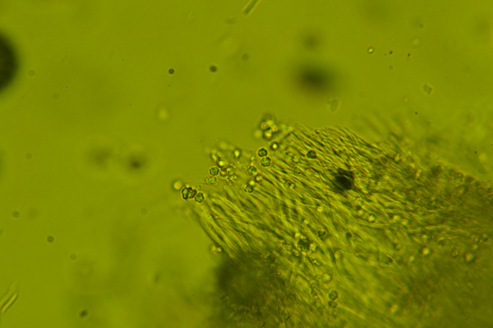 Sidera lenis image