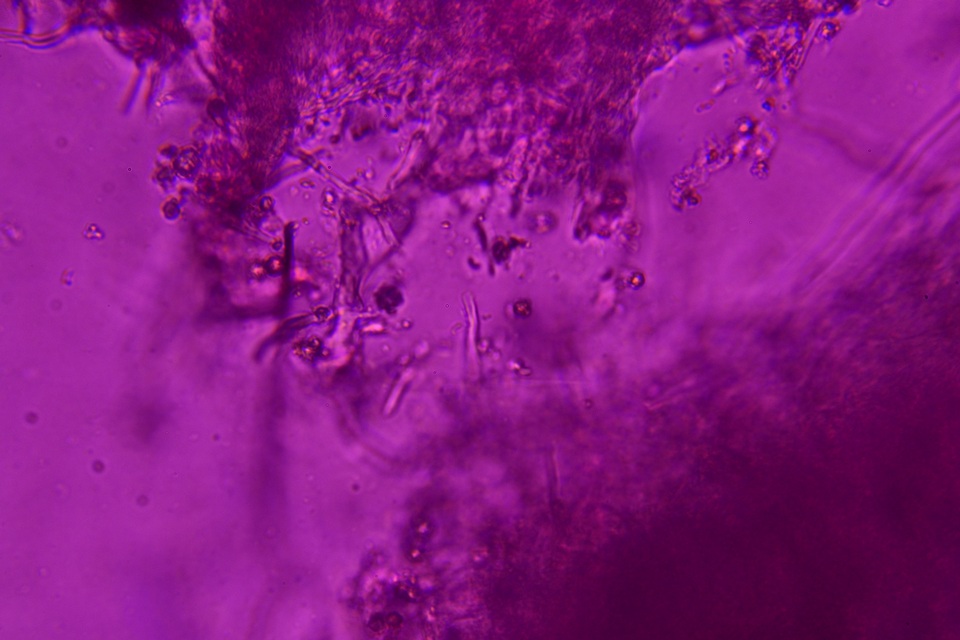 Sidera lenis image