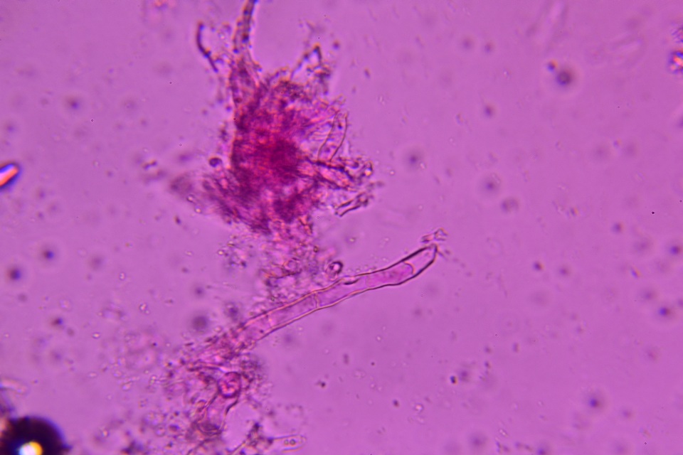 Colletotrichum dracaenophilum image