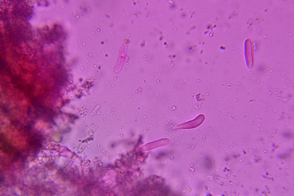 Colletotrichum dracaenophilum image