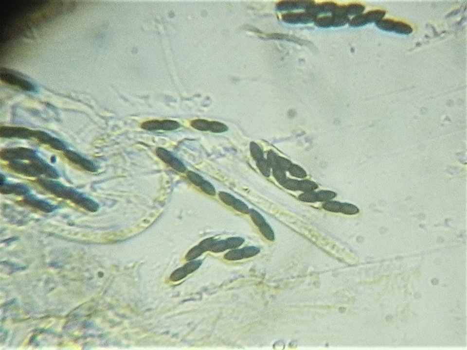 Trichodelitschia munkii image