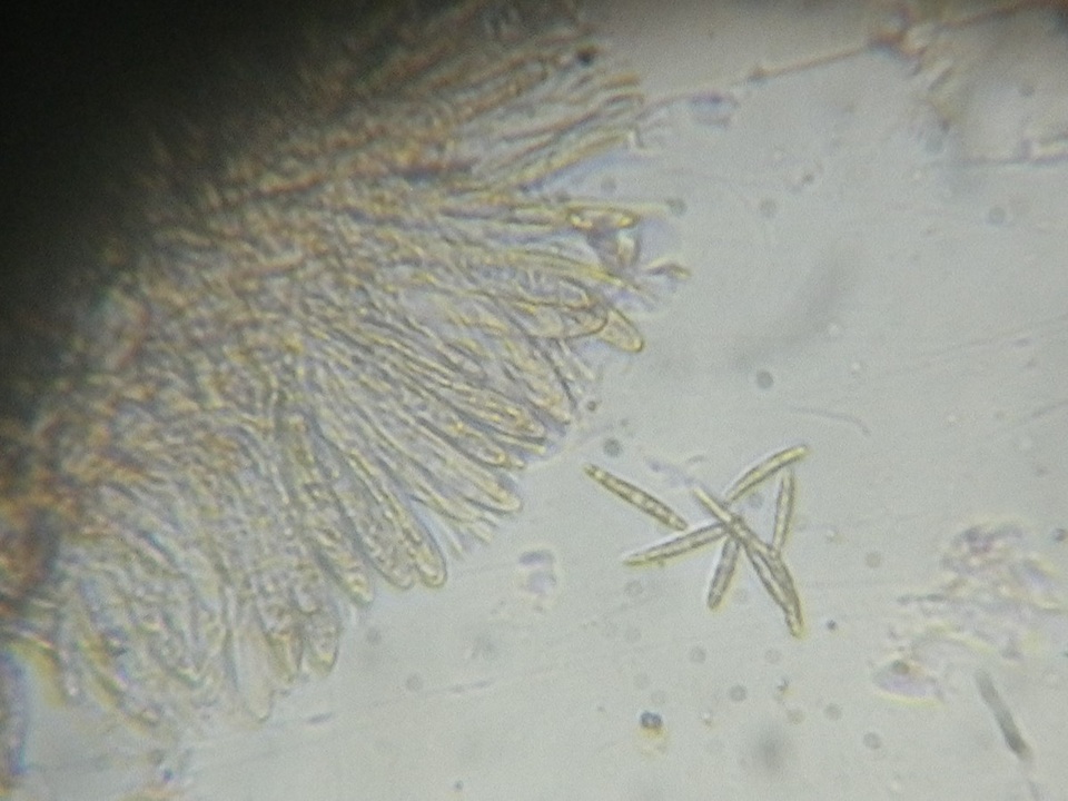 Arachnopeziza obtusipila image