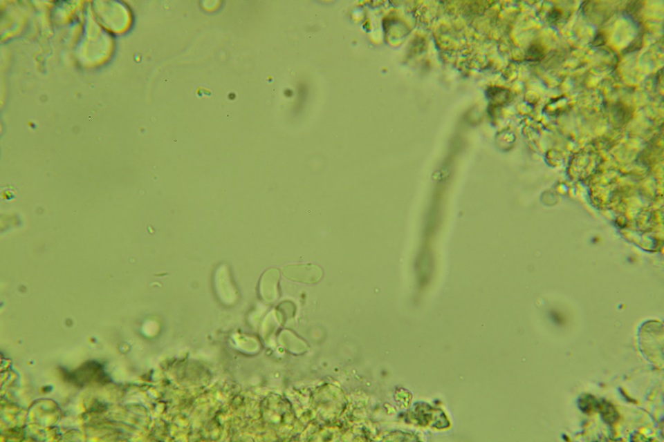 Eichleriella macrospora image