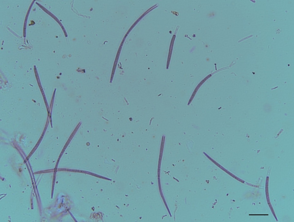 Cyclaneusma minus image