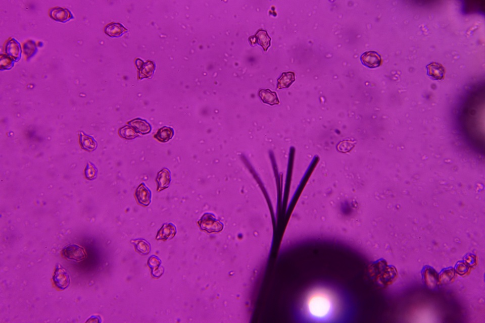Entoloma hirtum image