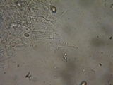 Lepista irina image