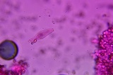 Inocybe lilacina image