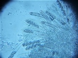 Mniaecia jungermanniae image
