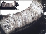 Pertusaria hymenea image