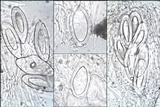 Pertusaria hymenea image