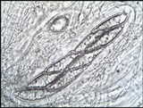 Pertusaria hymenea image