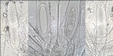 Pertusaria pustulata image