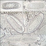 Pertusaria pustulata image