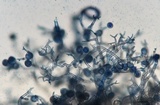 Peronospora corydalis image