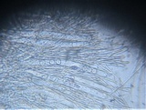 Pseudoplectania ericae image
