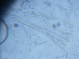 Pseudoplectania ericae image