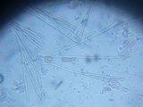 Pseudoplectania ericae image