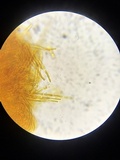 Lachnellula ellisiana image