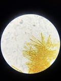Lachnellula ellisiana image