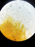 Lachnellula ellisiana image
