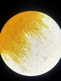 Lachnellula ellisiana image