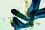 Lecidella euphorea image