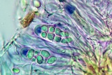 Lecidella euphorea image