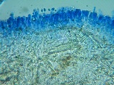 Sphaerobasidium minutum image